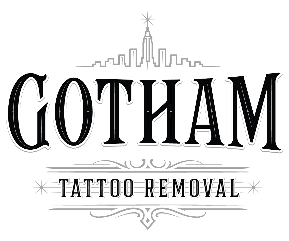 Gotham Tattoo Removal